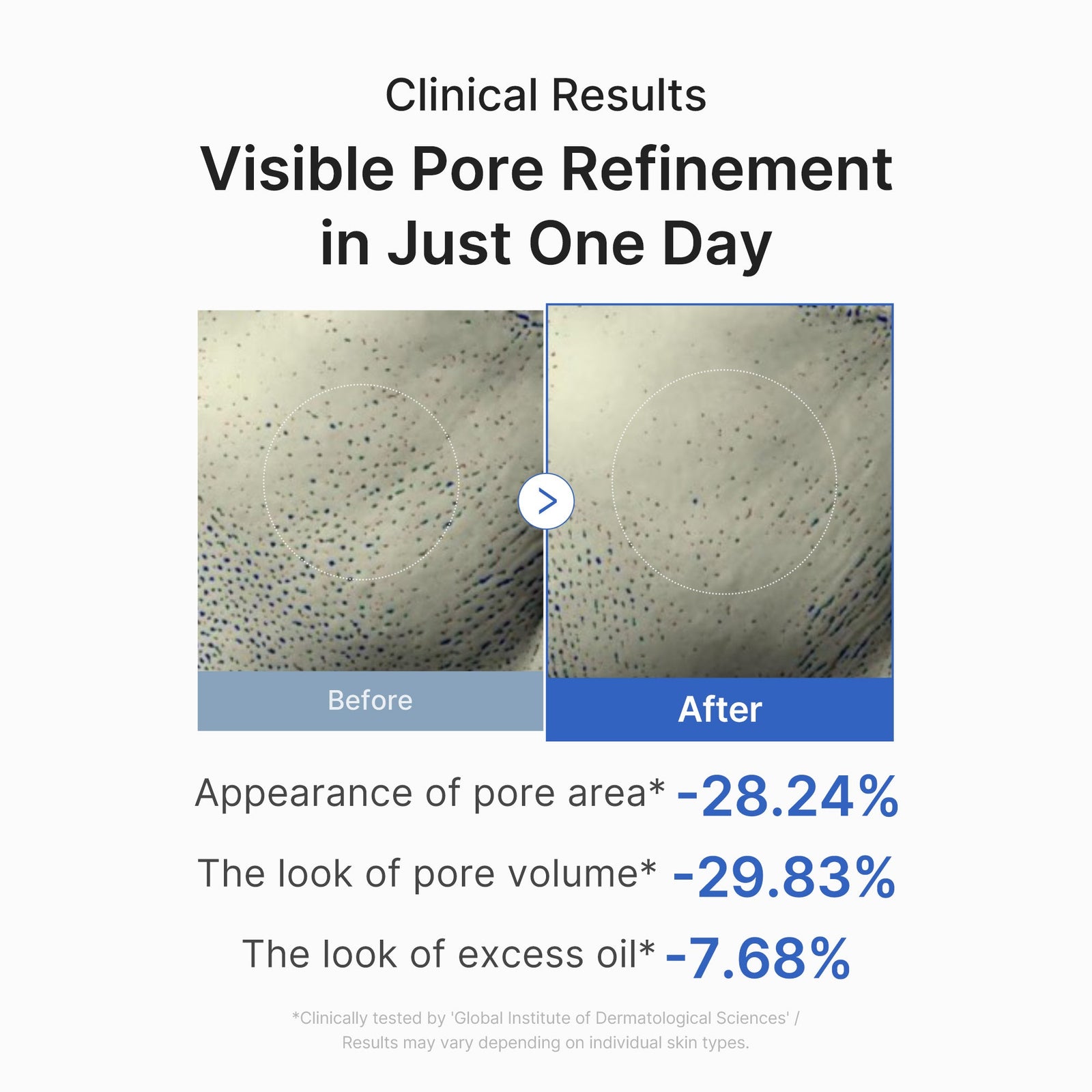 Zero Pore One-day Peptide Serum – view 5