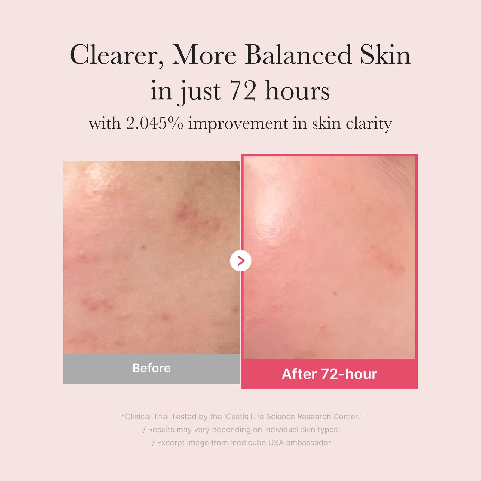 medicube TXA+Niacinamide 15% Glow Facial Seurm for After Spot Care 30ml - image 3 - ArabiaGlow UAE