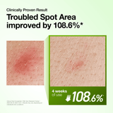 Anua Azelaic Acid 10 Hyaluron Redness Soothing Serum 30ml - image 4 - ArabiaGlow UAE